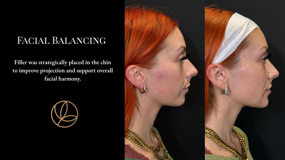 Facial Balancing