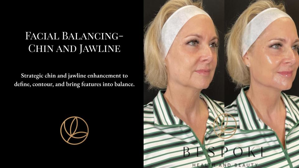 Facial Balancing Chin and Jawline