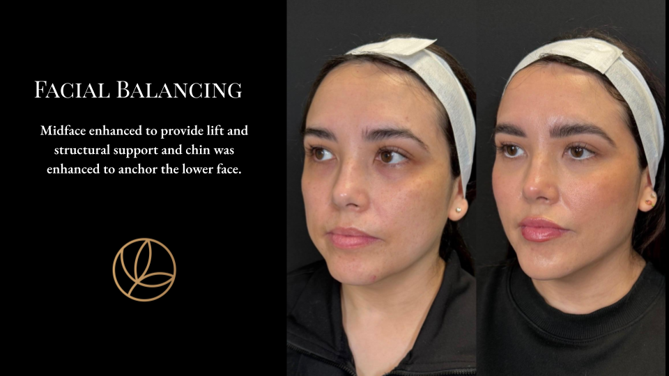 Facial Balancing
